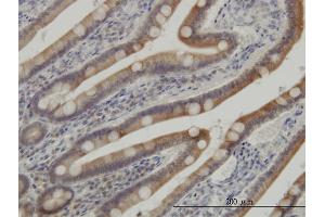 Immunoperoxidase of monoclonal antibody to CSNK1G1 on formalin-fixed paraffin-embedded human small Intestine. (CSNK1G1 Antikörper  (AA 293-393))