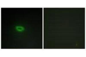 Immunofluorescence analysis of A549 cells, using ECRG4 antibody. (MEMO1 Antikörper)