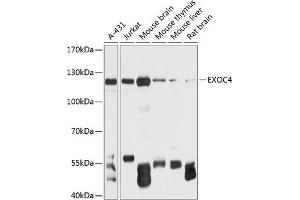 Western blot analysis of extracts of various cell lines, using EXOC4 antibody (ABIN6127883, ABIN6140366, ABIN6140367 and ABIN6215986) at 1:3000 dilution. (Sec8 Antikörper  (AA 1-280))