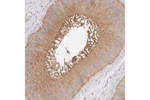 Immunohistochemical staining of human epididymis with TTLL4 polyclonal antibody  shows moderate cytoplasmic and membranous positivity in glandular cells. (TTLL4 Antikörper)