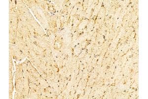 ABIN6265995 and ABIN6273344 at 1/100 staining Mouse heart tissue by IHC-P. (VPS11 Antikörper  (Internal Region))