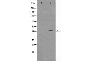 Western blot analysis on Jurkat cell lysate using NT5C3 Antibody,The lane on the left is treated with the antigen-specific peptide. (NT5C3 Antikörper  (N-Term))
