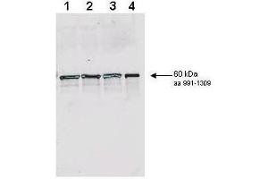 Affinity purified antibody to yeast Rad9 (1125-1139 pan reactive) was used at a 1:200 dilution incubated 8 h at room temperature to detect Rad9 by Western blot.