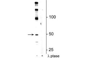 Western blot of mouse hippocampal lysate showing specific immunolabeling of the ~50 kDa eEF1A2 protein phosphorylated at Ser358 in the first lane (-). (EEF1A2 Antikörper  (pSer358))