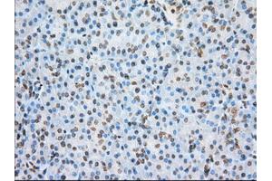 Immunohistochemical staining of paraffin-embedded colon tissue using anti-ERCC1 mouse monoclonal antibody. (ERCC1 Antikörper)