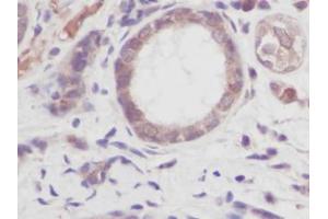 Image no. 1 for anti-Tumor Necrosis Factor alpha (TNF alpha) antibody (ABIN465030) (TNF alpha Antikörper)