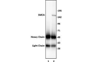 SMC4 antibody (pAb) tested by Immunoprecipitation. (SMC4 Antikörper  (N-Term))