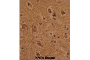 Immunohistochemistry (IHC) image for anti-CTD (Carboxy-terminal Domain, RNA Polymerase II, Polypeptide A) Phosphatase, Subunit 1 (CTDP1) antibody (ABIN3002722) (CTDP1 Antikörper)