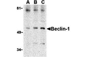 Western Blotting (WB) image for anti-Beclin 1, Autophagy Related (BECN1) (C-Term) antibody (ABIN1030289) (Beclin 1 Antikörper  (C-Term))