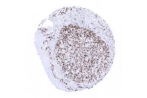 tonsil surface epithelium (Ki-67 Antikörper  (AA 2293-2478))