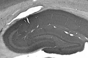Adult rat hippocampus immunohistochemistry. (CNTNAP2 Antikörper  (Extracellular))