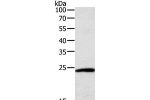 Western Blot analysis of Hela cell using SNAP25 Polyclonal Antibody at dilution of 1:400 (SNAP25 Antikörper)
