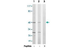 Western blot analysis of extracts from HepG2 cells (Lane 1 and lane 3) and HUVEC cells (Lane 2), using SLC16A14 polyclonal antibody . (SLC16A14 Antikörper)