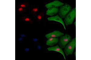 ABIN6263195 and ABIN6279528 staining  cells by IF/ICC. (MED29 Antikörper  (Internal Region))
