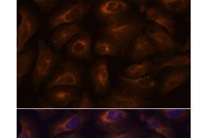 Immunofluorescence analysis of U-2 OS cells using GPR22 Polyclonal Antibody at dilution of 1:100. (GPR22 Antikörper)