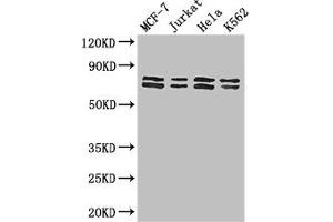 Western Blot Positive WB detected in: MCF-7 whole cell lysate, Jurkat whole cell lysate, Hela whole cell lysate, K562 whole cell lysate All lanes: TRIM25 antibody at 3 μg/mL Secondary Goat polyclonal to rabbit IgG at 1/50000 dilution Predicted band size: 71 kDa Observed band size: 71, 80 kDa