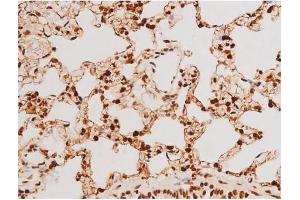 Immunohistochemistry (IHC) image for anti-Spleen tyrosine Kinase (SYK) (pTyr348) antibody (ABIN6255895)
