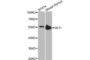 Western blot analysis of extracts of various cell lines, using DET1 antibody. (DET1 Antikörper  (AA 15-240))