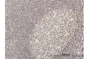Immunoperoxidase of monoclonal antibody to IFI16 on formalin-fixed paraffin-embedded human tonsil. (IFI16 Antikörper  (AA 630-729))