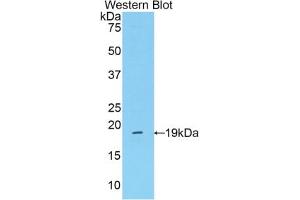 Western blot analysis of the recombinant protein. (Mannose Associated Serine Protease 2 (AA 280-433) Antikörper)