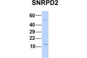 Host:  Rabbit  Target Name:  SNRPD2  Sample Type:  Human 293T  Antibody Dilution:  1. (SNRPD2 Antikörper  (N-Term))