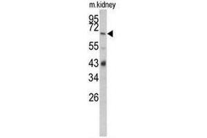 Western blot analysis of CFB Antibody (Center) in mouse kidney tissue lysates (35µg/lane). (Complement Factor B Antikörper  (Middle Region))