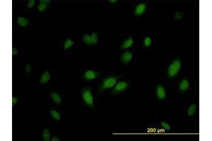 Image no. 3 for anti-RNA Guanine-7 Methyltransferase (RNMT) (AA 1-477) antibody (ABIN599057) (RNMT Antikörper  (AA 1-477))