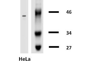 Western blotting analysis of human cytokeratin 18 using mouse monoclonal antibody DA-7 on lysates of HT-29 cell line and MOLT-4 cell line (cytokeratin non-expressing cell line, negative control) under non-reducing and reducing conditions. (Cytokeratin 18 Antikörper  (Biotin))