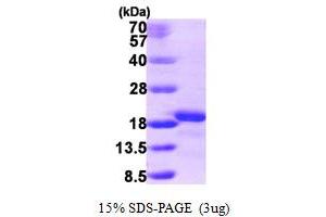 Ionized Calcium-binding Adapter Molecule 2 (IBA2) (AA 1-150) protein (His tag)