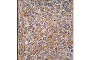 Immunohistochemistry (Paraffin-embedded Sections) (IHC (p)) image for anti-GIT1 (GIT1) (Tyr510) antibody (ABIN359576)