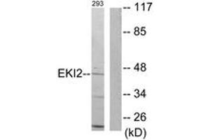 Western blot analysis of extracts from 293 cells, using EKI2 Antibody.