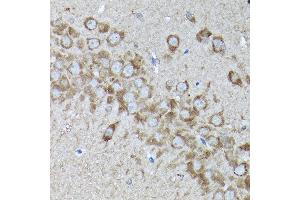 Immunohistochemistry of paraffin-embedded rat brain using SNAPIN Rabbit pAb  at dilution of 1:200 (40x lens). (SNAPIN Antikörper  (AA 1-136))