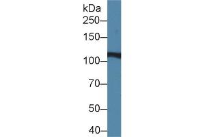 Western Blot; Sample: Rat Liver lysate; Primary Ab: 2µg/ml Rabbit Anti-Rat IREB2 Antibody Second Ab: 0. (IREB2 Antikörper  (AA 1-343))