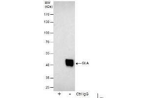 IP Image Immunoprecipitation of GLA protein from 293T whole cell extracts using 5 μg of Galactosidase alpha antibody [N1C2], Western blot analysis was performed using Galactosidase alpha antibody [N1C2], EasyBlot anti-Rabbit IgG  was used as a secondary reagent. (GLA Antikörper)
