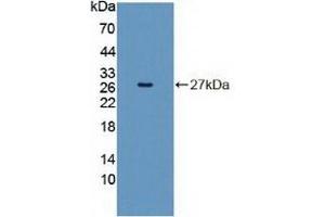 Detection of Recombinant INSRR, Human using Polyclonal Antibody to Insulin Receptor Related Receptor (INSRR)