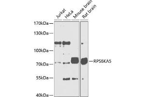 Western blot analysis of extracts of various cell lines, using RPS6K Antibody (699) at 1:1000 dilution. (MSK1 Antikörper  (AA 700-800))