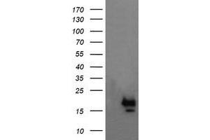 Image no. 1 for anti-NFKB Inhibitor Interacting Ras-Like 1 (NKIRAS1) antibody (ABIN1499743) (NKIRAS1 Antikörper)
