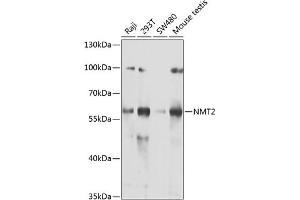 Western blot analysis of extracts of various cell lines, using NMT2 antibody (ABIN6130572, ABIN6144688, ABIN6144690 and ABIN6222825) at 1:1000 dilution. (NMT2 Antikörper  (AA 1-120))
