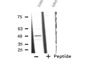 Western blot analysis of extracts from LOVO cells, using RAD23A antibody. (RAD23A Antikörper  (C-Term))