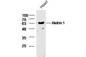 Mouse heart lysates probed with Rabbit Anti-Netrin 1 Polyclonal Antibody, Unconjugated  at 1:5000 for 90 min at 37˚C. (Netrin 1 Antikörper  (AA 501-604))