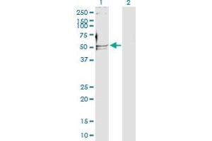 Western Blotting (WB) image for anti-Polymerase (DNA Directed), delta 2, Accessory Subunit (POLD2) (AA 1-469) antibody (ABIN519021)