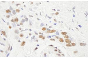 Immunohistochemistry (IHC) image for anti-Nuclear Transcription Factor Y, alpha (NFYA) (AA 333-347) antibody (ABIN7448690) (NFYA Antikörper  (AA 333-347))