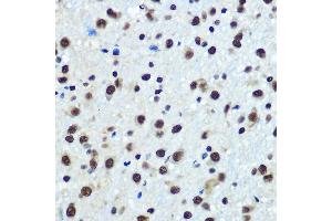 Immunohistochemistry of paraffin-embedded rat brain using hnRNP K Rabbit mAb (ABIN7267634) at dilution of 1:100 (40x lens). (HNRNPK Antikörper)