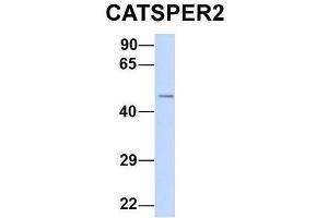 Host:  Rabbit  Target Name:  CATSPER2  Sample Type:  Human 293T  Antibody Dilution:  1.