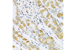 Immunohistochemistry of paraffin-embedded human stomach using PSG1 antibody at dilution of 1:100 (40x lens). (PSG1 Antikörper)