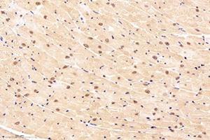 Immunohistochemistry analysis of paraffin-embedded mouse heart using,NOS1AP (ABIN7074844) at dilution of 1: 4000 (NOS1AP Antikörper)