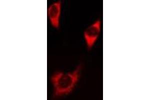 ABIN6275828 staining NIH-3T3 cells by IF/ICC.