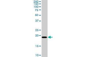 SRI monoclonal antibody (M01), clone 1E12. (SRI Antikörper  (AA 1-198))