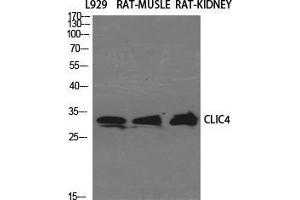 Western Blot (WB) analysis of specific cells using CLIC4 Polyclonal Antibody. (CLIC4 Antikörper  (N-Term))