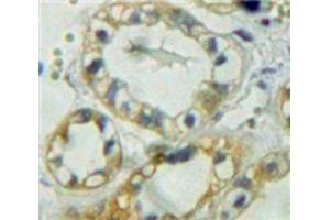 Used in DAB staining on fromalin fixed paraffin-embedded Kidney tissue (PTPRM Antikörper  (AA 1197-1403))